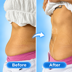Skin Tightening Lift Patches